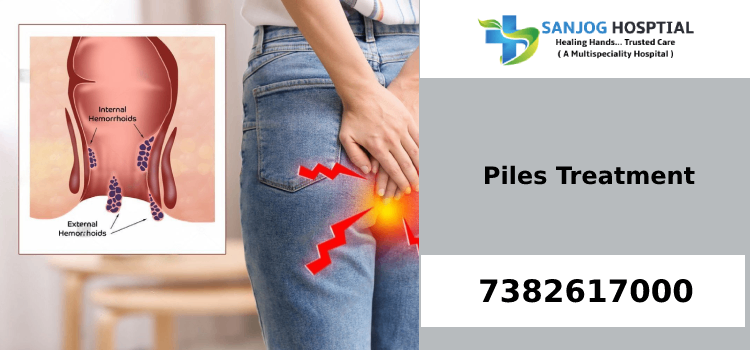 Piles Treatment